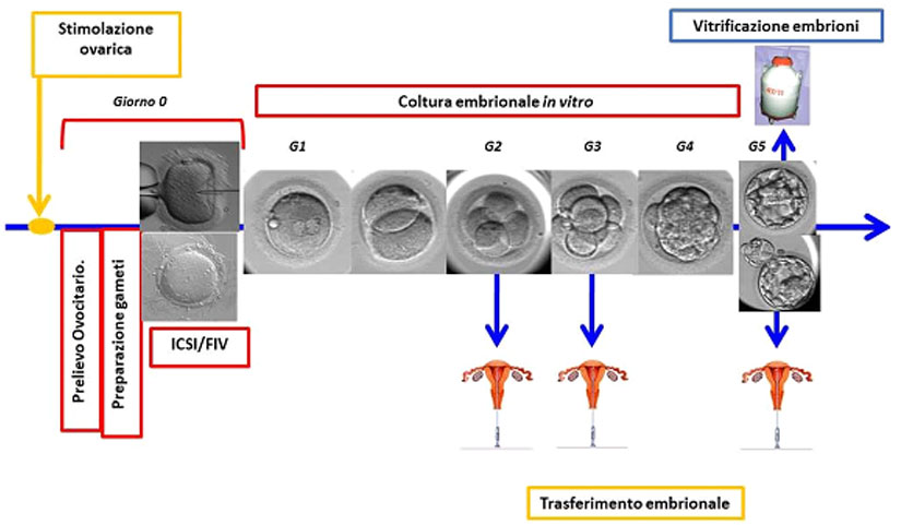 fecondazione in vitro e trasferimento embrionale
