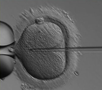 iniezione intra - citoplasmatica di uno spermatozoo